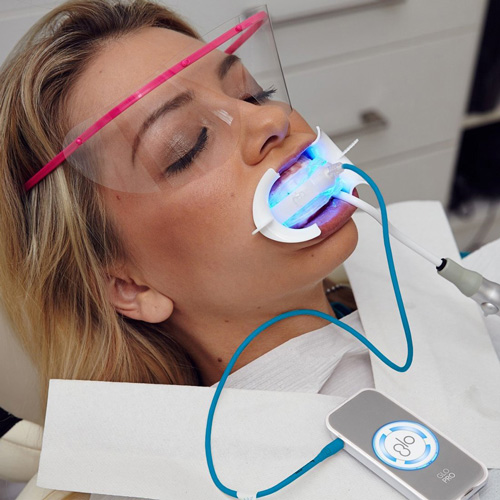 chairside-GLO-teeth-whitening-procedure